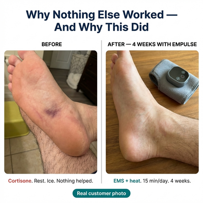 EmPulse — EMS Deep Foot Recovery